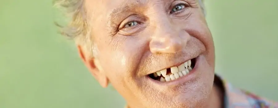 Homme dans la cinquantaine qui sourit, mais dont il manque une dent.